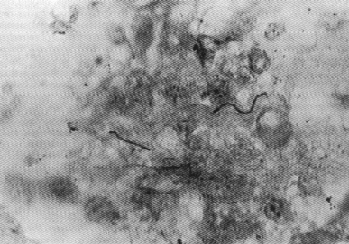 Borrelia