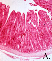 The crypts are elongated and tortuous with marked proliferation of enterocytes and occasionally goblet cells