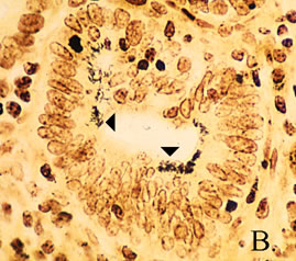 Silver stains (B.)   are needed to reveal numerous curved bacilli (arrows) in the apical cytoplasm of the enterocytes