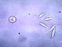 Spironucleus muris, image from MURADIL DORA