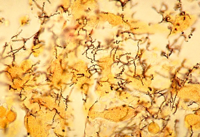 Treponema in rabbit testis, silver stain